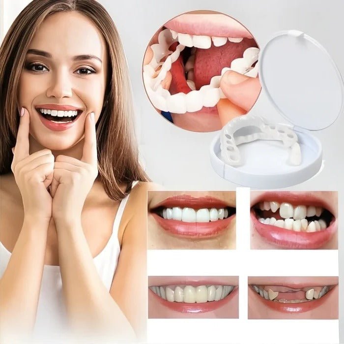 Veneers for Teeth with Natural White Finish - TRENDVYO