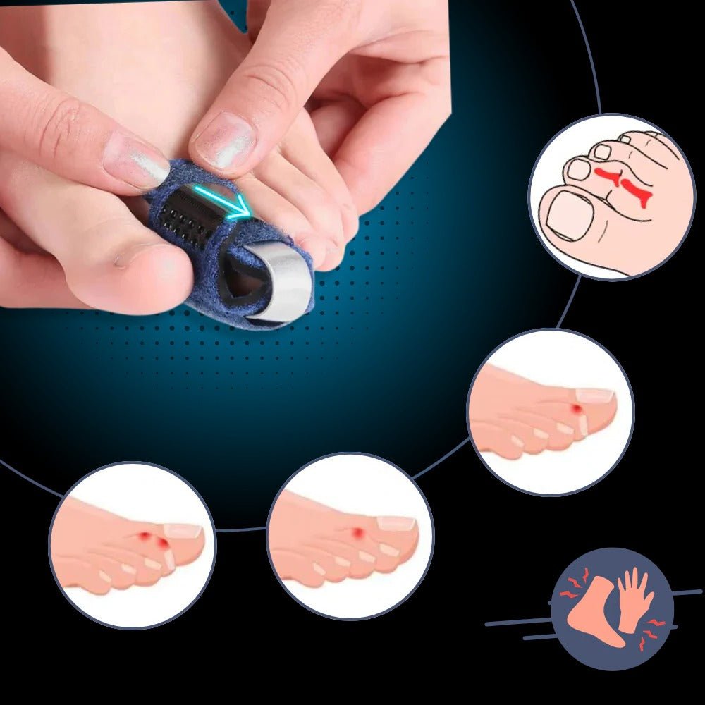 Toe Straightener with Adjustable Support - TRENDVYO